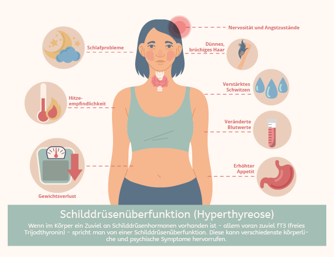 Infografik zu den Symptomen einer Schilddrüsenüberfunktion