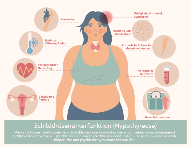 Infografik Symptome Schilddrüsenunterfunktion 